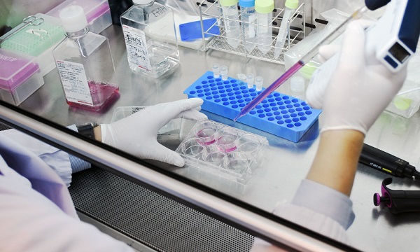 Challenge To Develop A Novel Therapeutic Drug For Muscular Dystrophy Academist アカデミスト